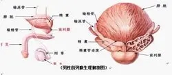 前列腺结石症状,前列腺结石原因,前列腺结石治疗,前列腺结石图片