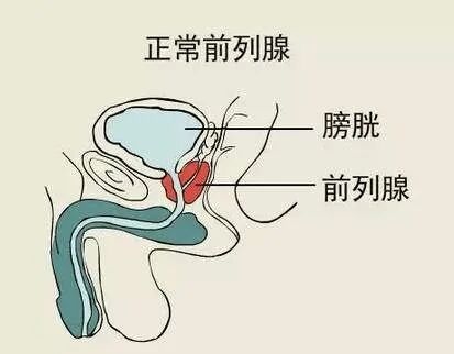 前列腺增生原因,前列腺增生药物,前列腺增生治疗,前列腺增生症状