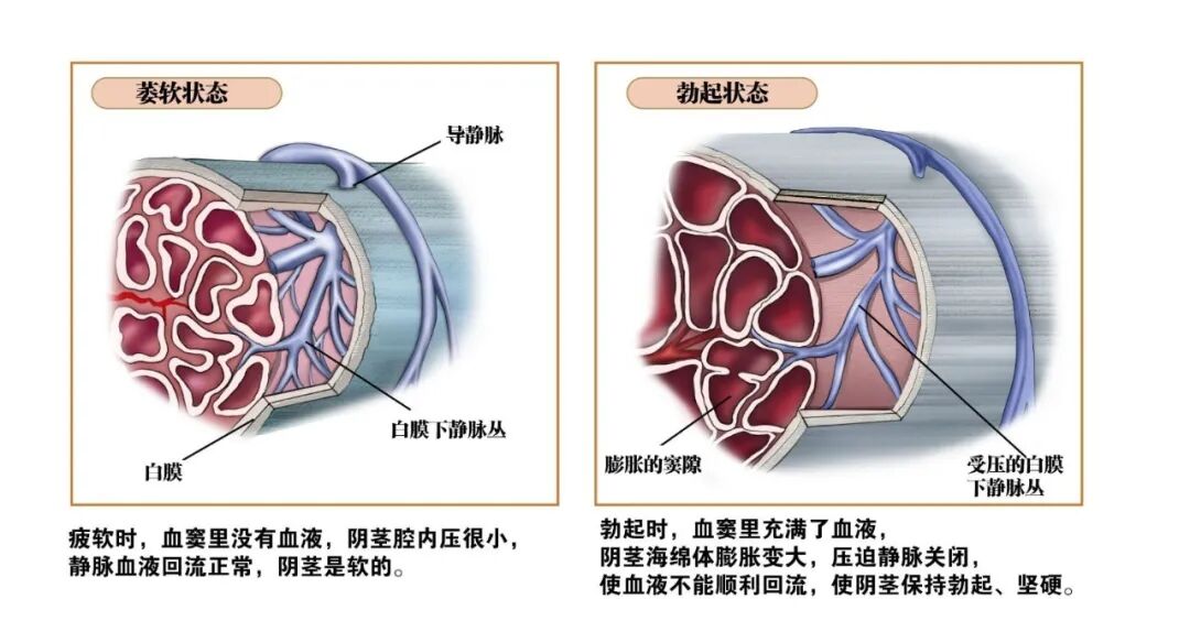 勃起功能障碍病因,勃起功能障碍预防,勃起功能障碍治疗,勃起功能障碍诊断,勃起功能障碍症状