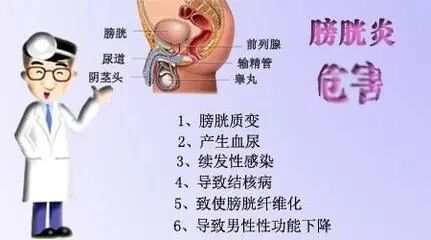 膀胱炎症状,膀胱炎治疗,膀胱炎男性,膀胱炎用药