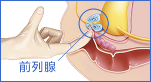 前列腺增生药物,前列腺增生原因,前列腺增生症状,前列腺增生治疗