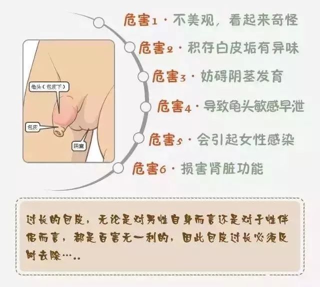 包皮过长症状,包皮过长表现,包皮过长病因,包皮过长预防,包皮过长检查,包皮过长危害