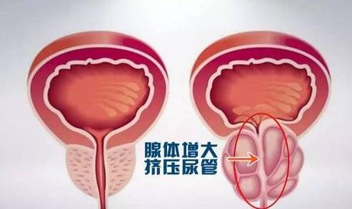 ǰ֢״,ǰ,ǰ,ǰԤ,ǰ,ǰΣ