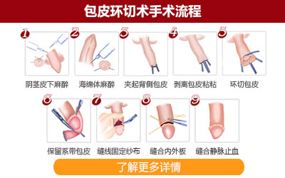 包皮过长症状,包皮过长表现,包皮过长病因,包皮过长预防,包皮过长检查,包皮过长危害