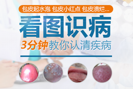 生殖器疱疹症状,生殖器疱疹表现,生殖器疱疹病因,生殖器疱疹预防,生殖器疱疹检查,生殖器疱疹危害