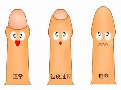 ʿƤҪ𣿶Ը